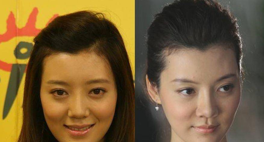 整形这是我见过最敢的女星，猪鼻子还能演美女？
