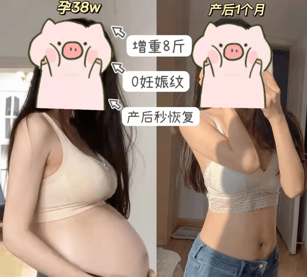 还在信橄榄油防纹 孕期做好这三件事 完美避开妊娠纹 医生都夸 皮肤