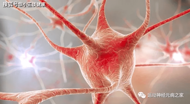 治疗|运动神经元渐冻症治疗第110例分享!