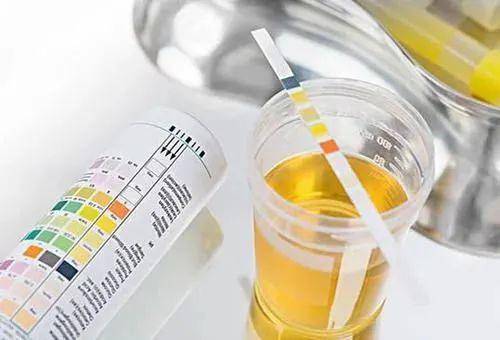 水平|亲睐控糖 糖友们的化验单 弄清楚这几点 自己也能看得懂！