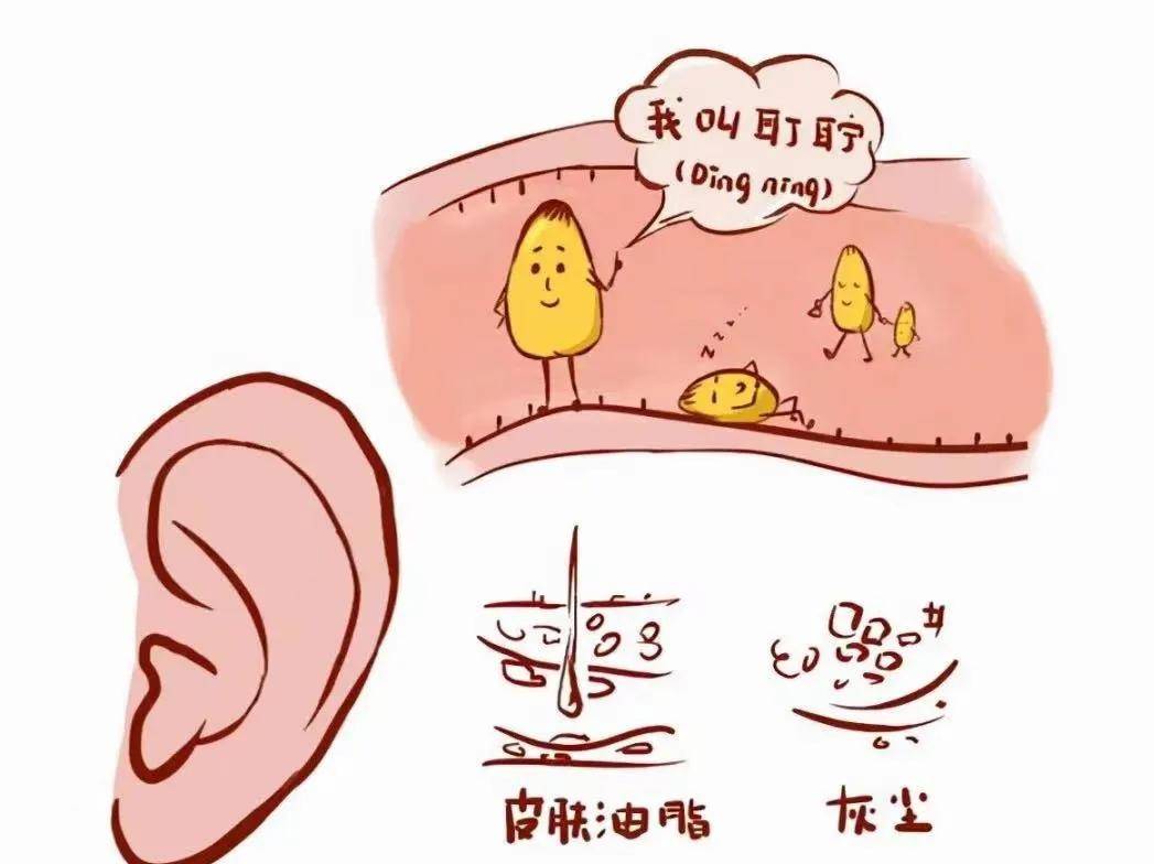 掏耳朵有多爽,一直掏一直爽,经常掏真的对耳朵有伤害吗?_耳屎