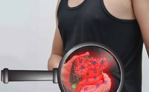 进行|得了肝病，如何治疗好？注意这5个细节，让肝脏好得更快