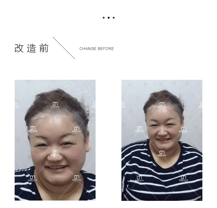 假发女士形象改造！胖阿姨变靓妹！