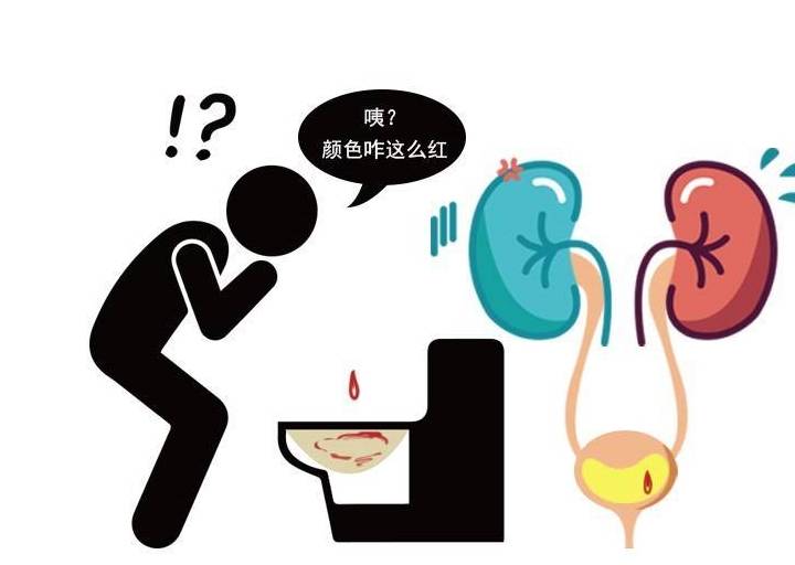 物质|肾功能不好的人，人体会出现10中异常，出现3个就要高度重视