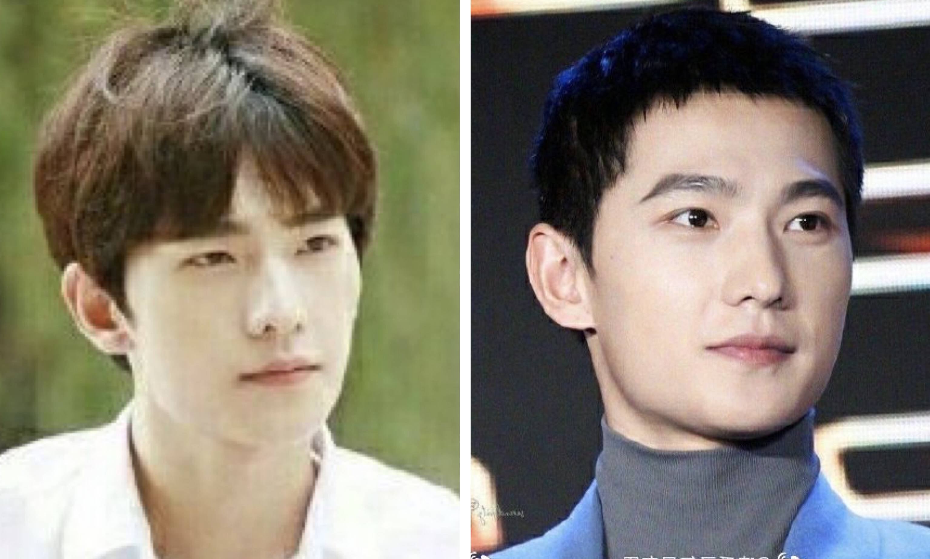 脸部事实证明,明星美貌的天敌不是发福,而是“发腮”啊?