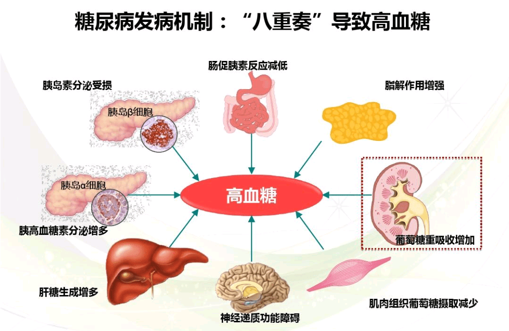 科普|世界糖尿病日|徽真堂科普糖尿病知識掃盲