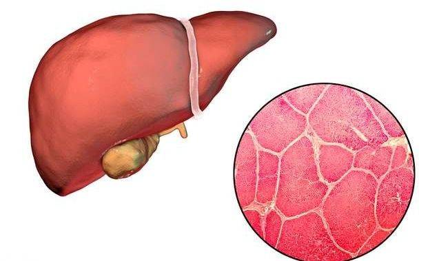 肝脏|养成这个好习惯可以帮助你避免肝脏疾病