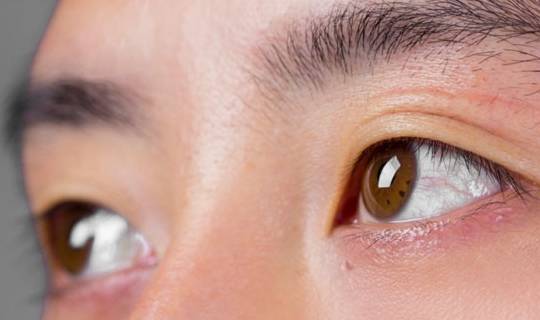 眼睛|肝病“找上门”时，身体可能出现这4种情况，别忽视，及时就医