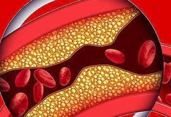 血管|有了糖尿病就真的没办法了吗？今后与正常人的生活差别有多大？
