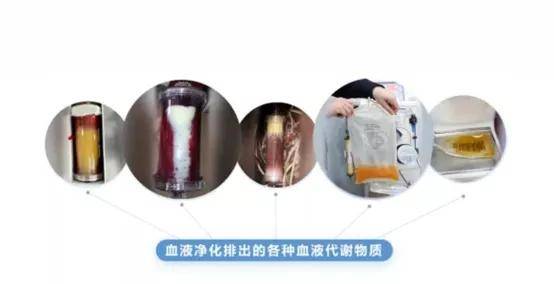 水平|4成血脂异常！！国人健康何以为继？？