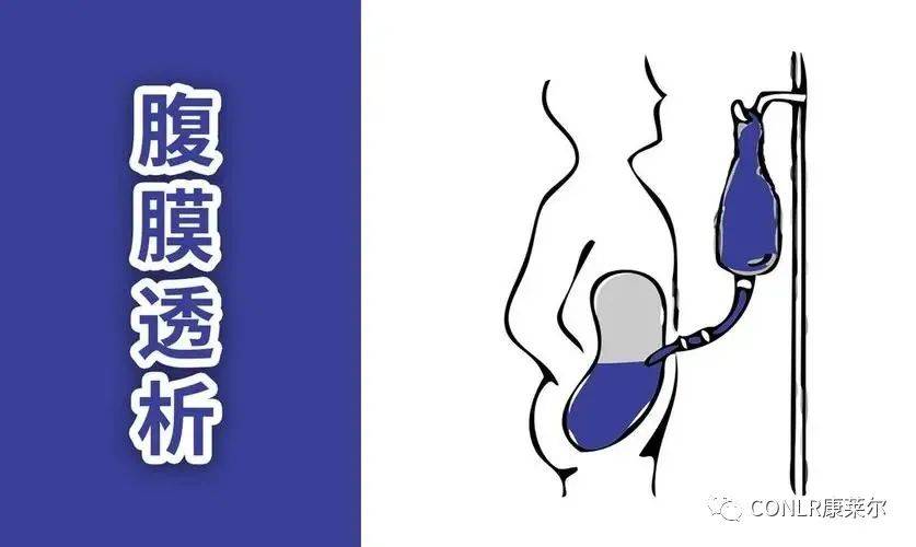 治疗|肾脏替代治疗有哪些方式？