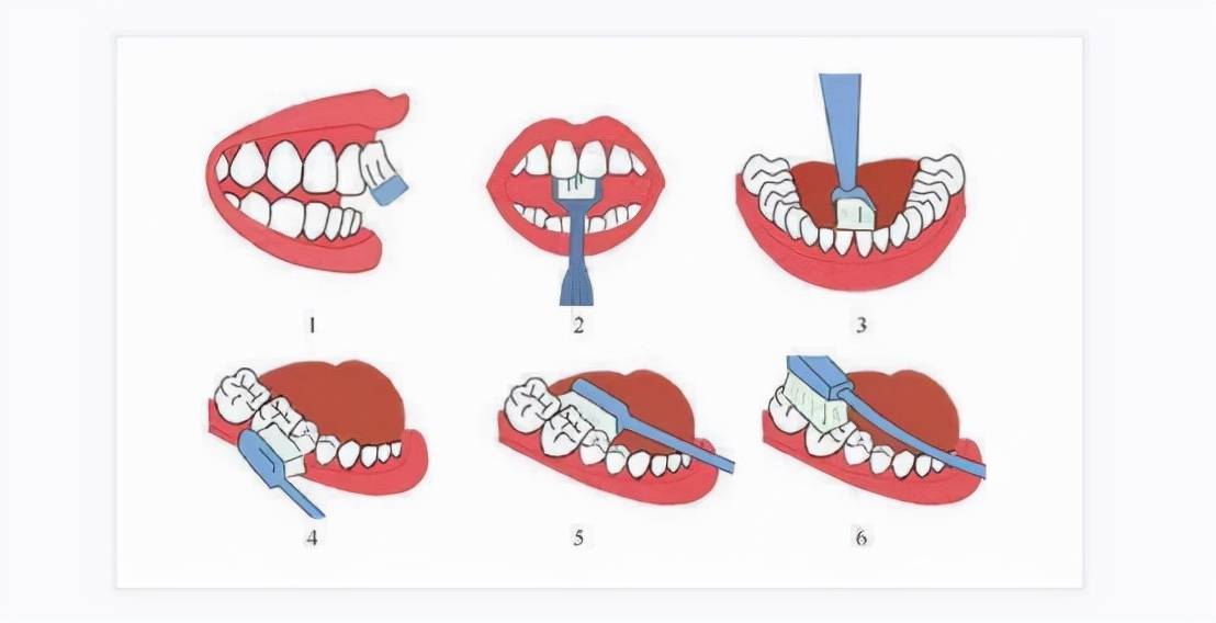 排牙的方法步骤图解图片