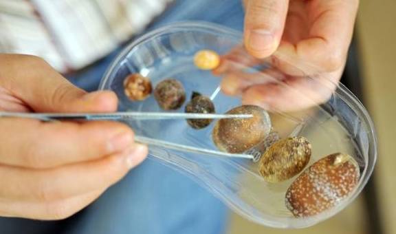 功效|防治肾结石，可多吃核桃等5种食物有益处