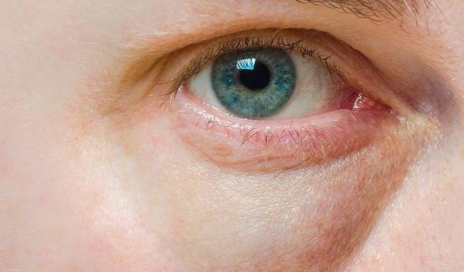 血液|男人肾好，女人幸福，若没有这5个表现，恭喜肾还不错！