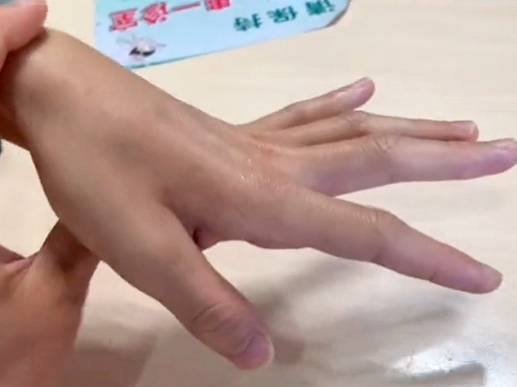 危害|【百科】運動神經元病造成“關節僵硬”，得病危害傷及全身