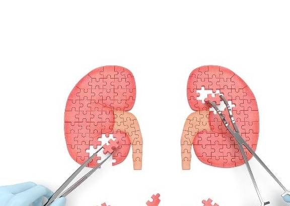 肾脏|“尿毒症”是如何引起的？患上尿毒症后，还能活多久？