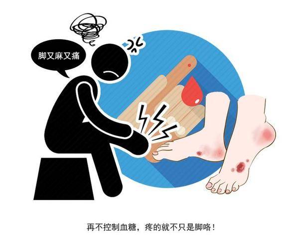 全占|睡觉时3个症状你全占，很遗憾，你可能是糖尿病候选人！自查一下