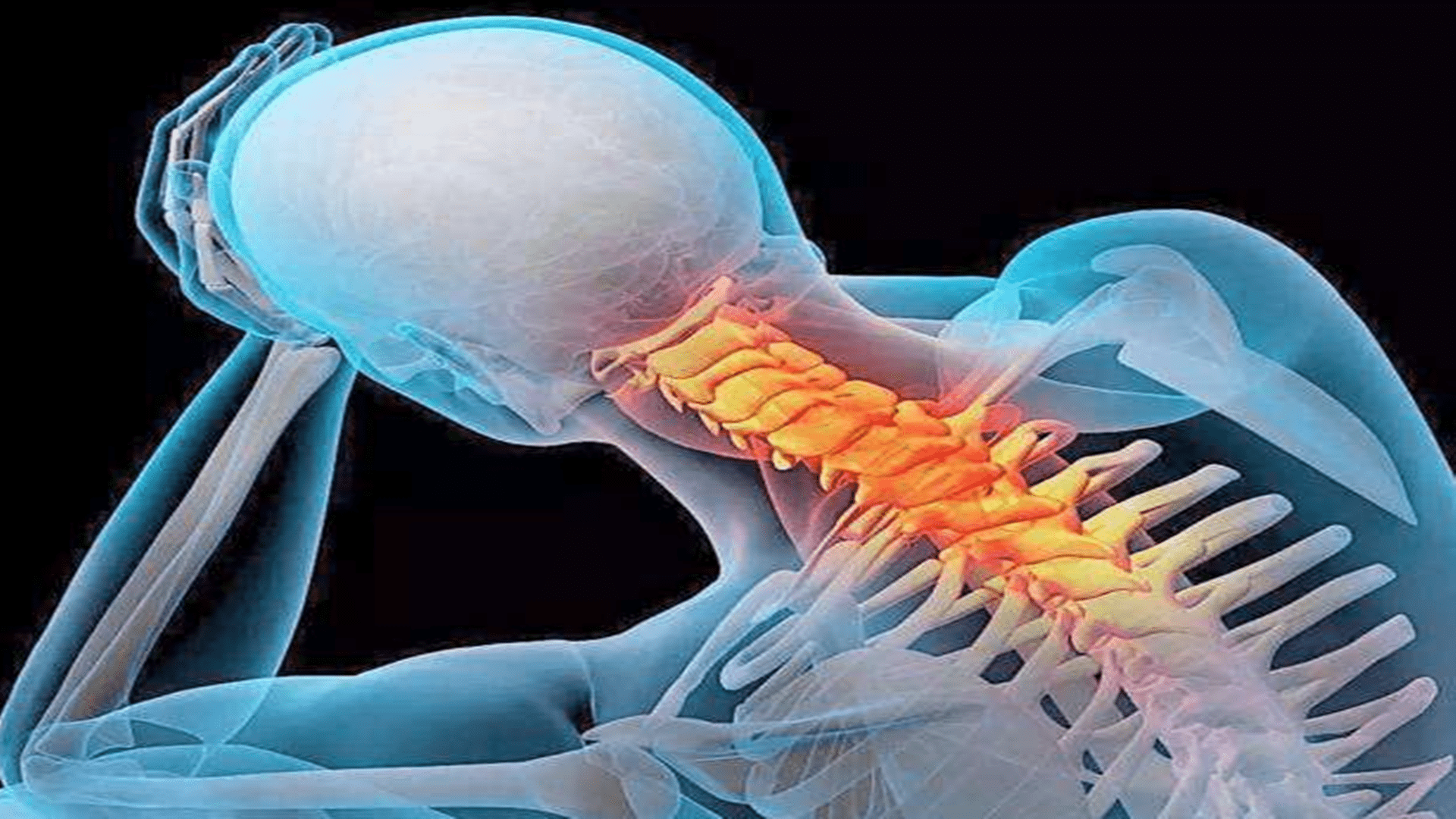 颈椎|病起来“要命”，中风、脑瘫要当心，别等病了才后悔莫及