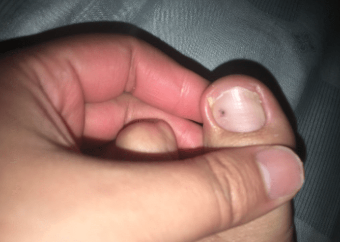 肝脏|肝脏向你求救会发出4大信号！坚持做好4个小习惯，还有的救