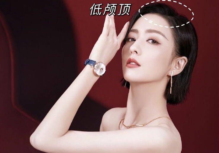 因为容貌焦虑到发疯，用水泥填颅顶！请停止颅顶焦虑