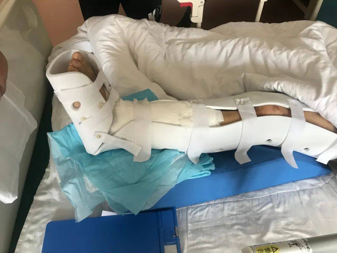 手术治疗 荣大医院骨科李墨主任主刀为患者进行了骨折切开复位内固