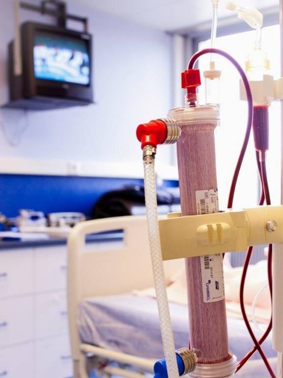 治疗|慢性肾衰竭患者血液透析护理研究进展分析