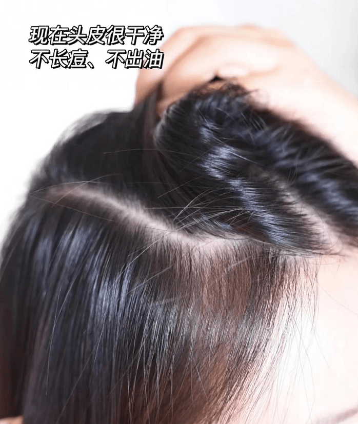 头皮爱上金晨乌黑秀发？Forvil温莎森林教你做精细化养护发达人