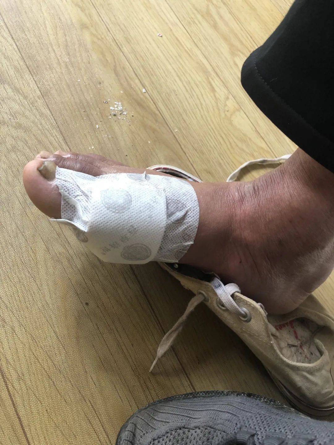 治疗|百草济世：不死的癌症——痛风，看中医如何治！