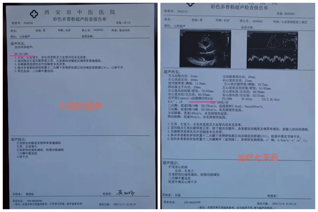 病例二患者黄某41岁