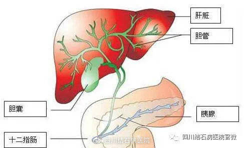 胆囊_患者_胆汁