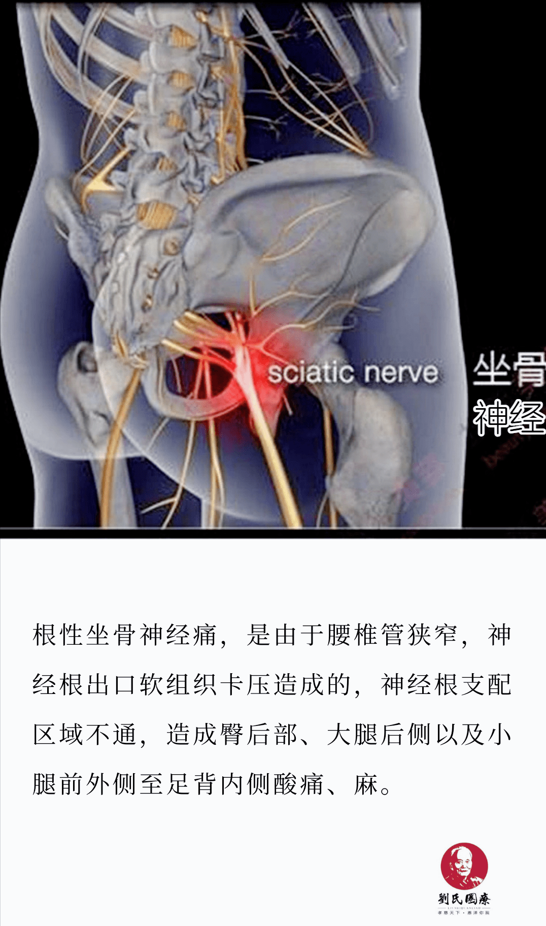 27岁小伙自小腰疼,走路伸脚像触电,医生:晚了成残废