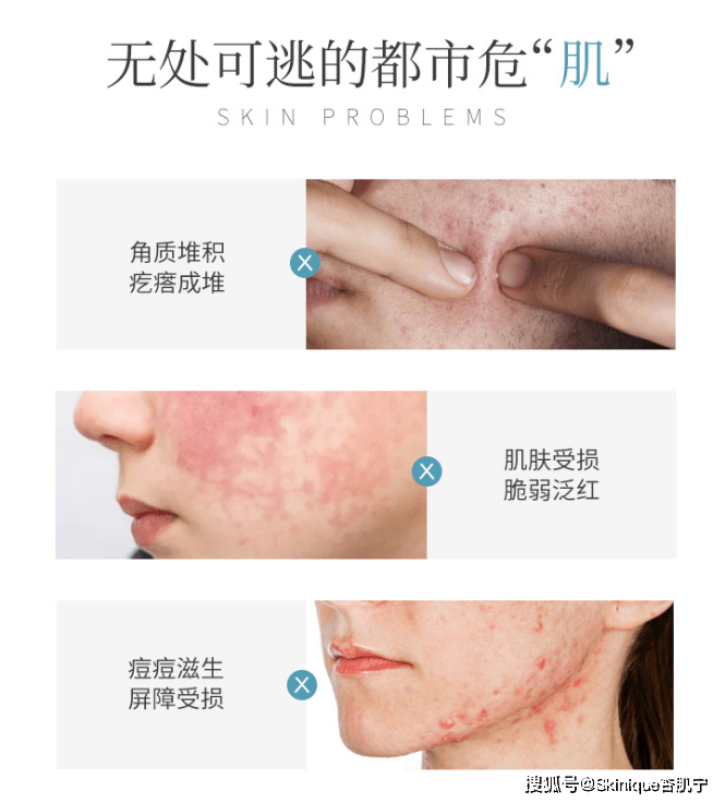 都市如何远离都市危“肌”，焕活年轻好肌肤呢？