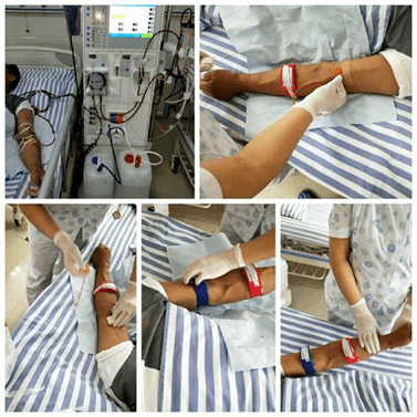 血管|糖尿病可能发生的并发症