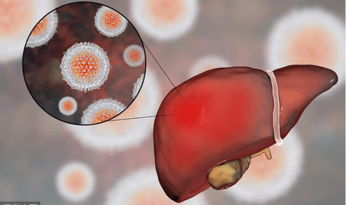 大姐|42岁大姐腹泻入院肝脏“瘫痪”！医生：糊涂！3种早餐怎能天天吃