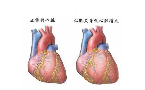 什么是心脏器质性疾病 0ced14753e8b425094028d4e0e00b3b3.jpeg