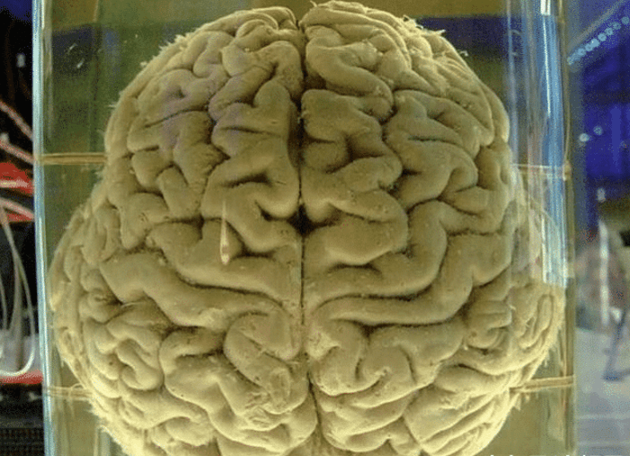 多生理学家用脑组织切片做实验,然后将大脑从动物身上取出来之后然后