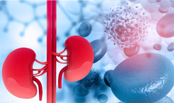 治疗|肌酐升高到400离尿毒症不远了？稳住2点，肾功能还有回转余地