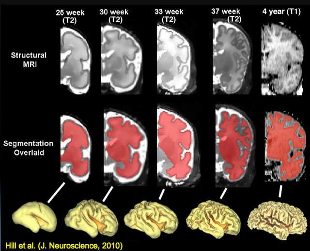 大脑发育过程演示 f05ef98fb64d4f9e922365430a7e877f.jpeg