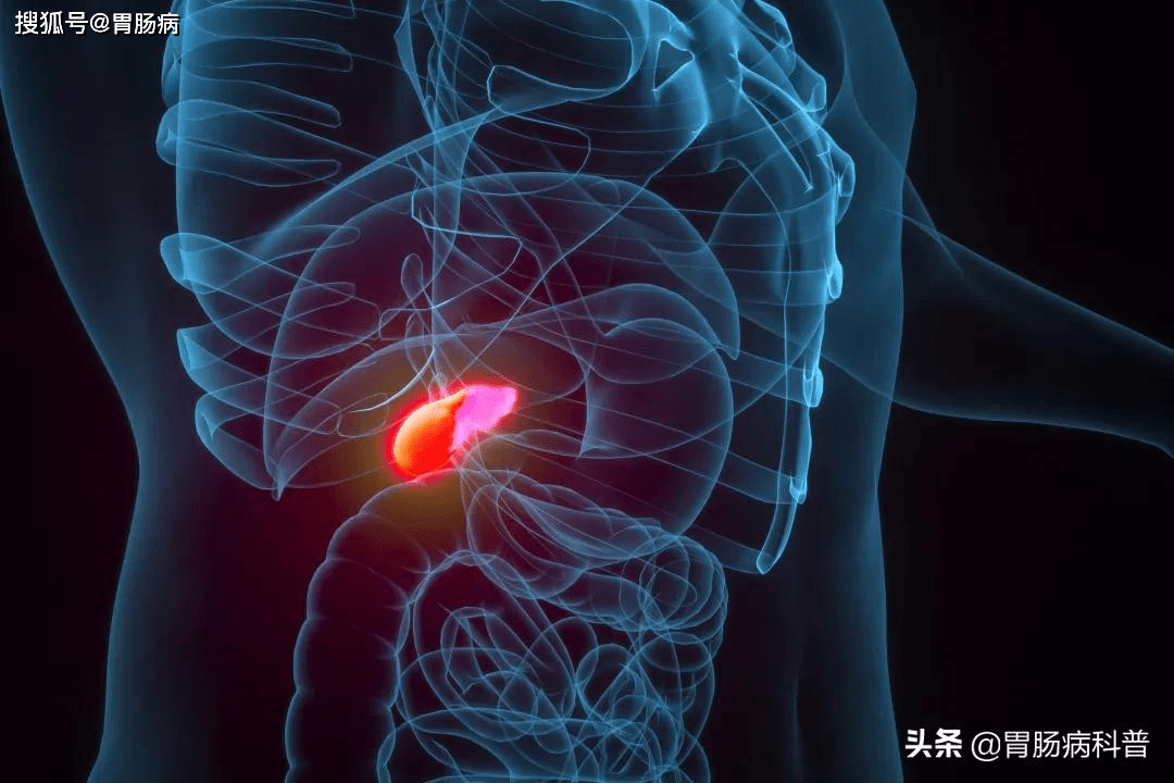 我叫胆囊结石是你的大麻烦