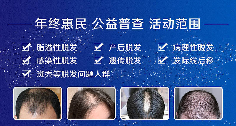 kDa|成都平安医院脱发问题“秃”出 这个年终惠民公益普查不能错过