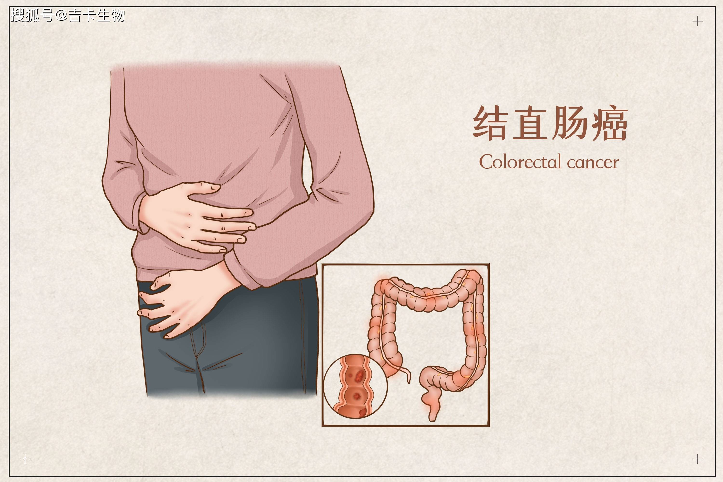 基于dna甲基化分子标志物进行结直肠癌crc早期筛查