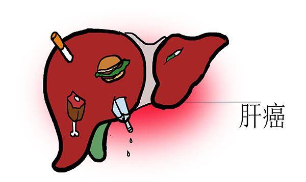 血液|从乙肝发展到肝癌,大约要10年?医生:别有侥幸心理,尽早预防