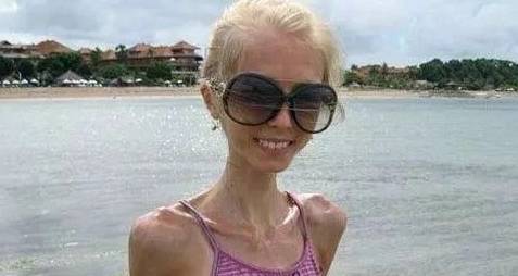 青色|肝脏不好的人,身体会出现6种表现,若没有,肝脏还算健康