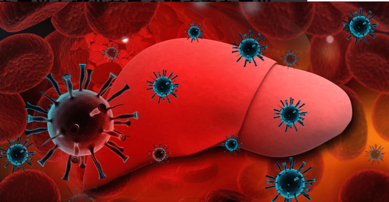 治疗|得了肝硬化还可以活多久?硬化的肝脏还能逆转吗?