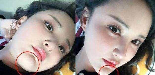 下巴明星的N种“假下巴”，尖到戳死人，翘成老巫婆，一个比一个怪异