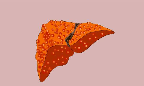 肝脏|动不动就拉肚子，是肠胃不好？医生：伴随3个异常，可能是肝病了