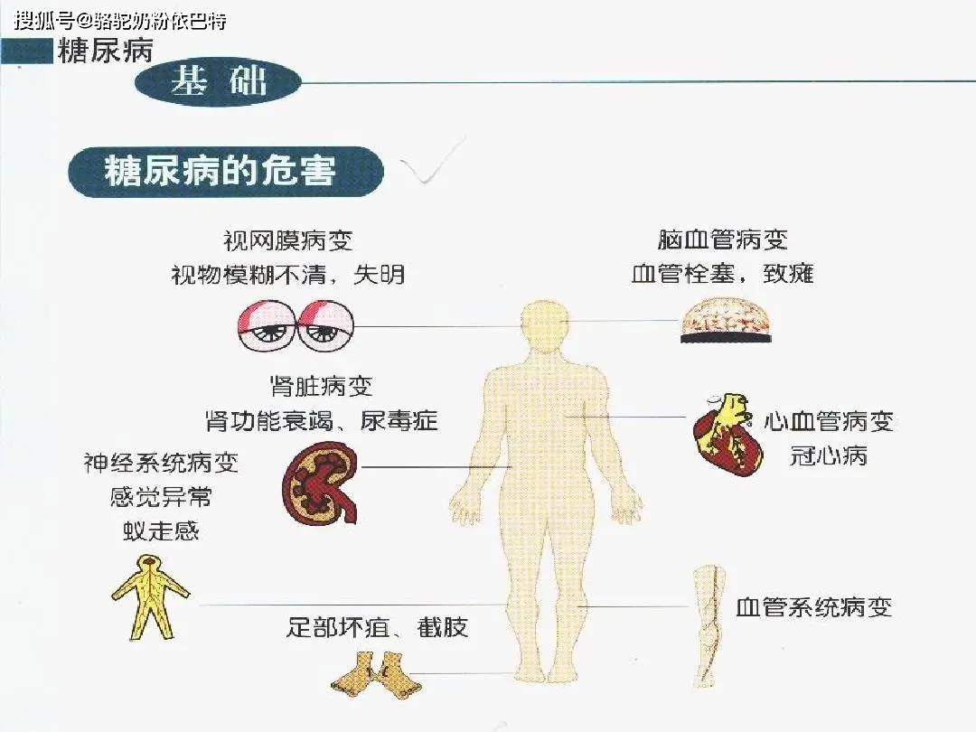 糖高人士可以喝駝奶嗎駝奶對糖高人士有什麼幫助