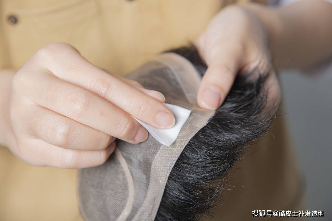 胶布粘在头发上怎么办