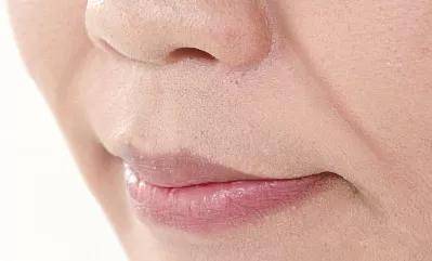 宋轶凸嘴无法修复的四种迹象,千万别中招