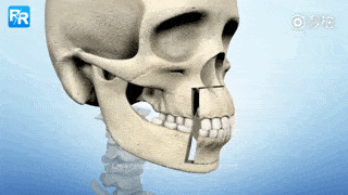 宋轶凸嘴无法修复的四种迹象,千万别中招